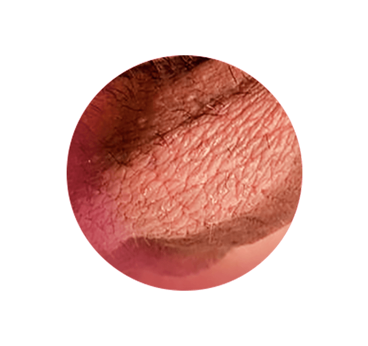 Block Image